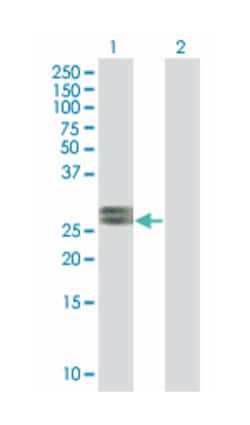 fibroblast growth factor 19, Mouse, Polyclonal Antibody, Abnova 50&mu;L;