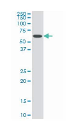 nuclear receptor subfamily 1, group H, member 4, Mouse, Clone: 1B10, Abnova