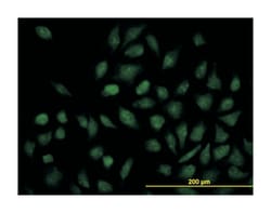 nuclear receptor subfamily 1, group H, member 4, Mouse, Clone: 1B10, Abnova