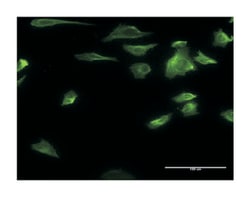 HDAC6, Mouse, Clone: 3A6, Abnova&trade;