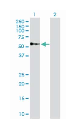 target of myb1 (chicken), Rabbit, Purified MaxPab Polyclonal Antibody, Abnova 100 &mu;g | Buy Online | Abnova | Fisher Scientific