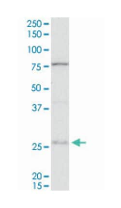 DnaJ (Hsp40) homolog, subfamily B, member 6 (A01), Mouse anti-Human, Rat,