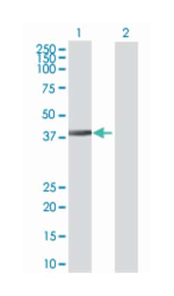 DnaJ (Hsp40) homolog, subfamily B, member 6 (B01), Mouse anti-Human, Polyclonal