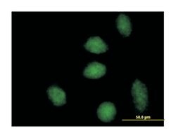 DnaJ (Hsp40) homolog, subfamily B, member 6 (B01), Mouse anti-Human, Polyclonal