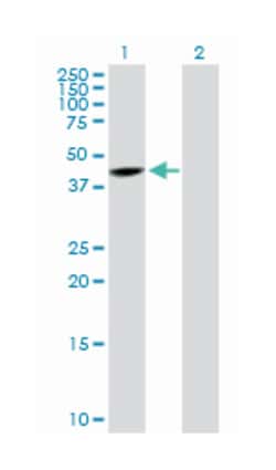 snurportin 1, Rabbit, Purified MaxPab™ Polyclonal Antibody, Abnova™