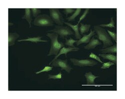 CTD (carboxy-terminal domain, RNA polymerase II, polypeptide A) small phosphatase