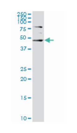 serum/glucocorticoid regulated kinase 2, Mouse, Clone: 4G4, Abnova 100&mu;g;