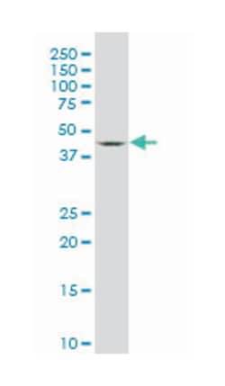 serum/glucocorticoid regulated kinase 2, Mouse, Clone: 4G4, Abnova 100&mu;g;