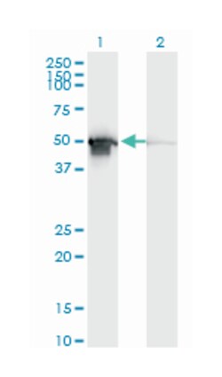 PDIA6, Mouse, Clone: 3B4, Abnova™