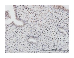 transducer of ERBB2, 1, Mouse, Purified MaxPab Polyclonal Antibody, Abnova