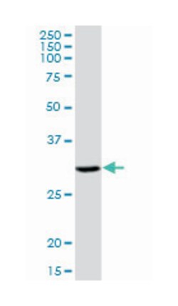 dehydrogenase/reductase (SDR family) member 9, Mouse, Purified MaxPab Polyclonal Antibody, Abnova 50 &mu;g | Buy Online | Abnova Corporation | Fisher Scientific