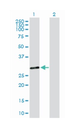 dehydrogenase/reductase (SDR family) member 9, Rabbit, Purified MaxPab