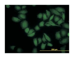 serum/glucocorticoid regulated kinase 2, Mouse, Clone: 4G4, Abnova 100&mu;g;