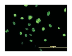 transducer of ERBB2, 1, Mouse, Purified MaxPab Polyclonal Antibody, Abnova