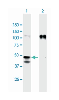 glycoprotein A33 (transmembrane), Mouse, Polyclonal Antibody, Abnova 50&mu;L;