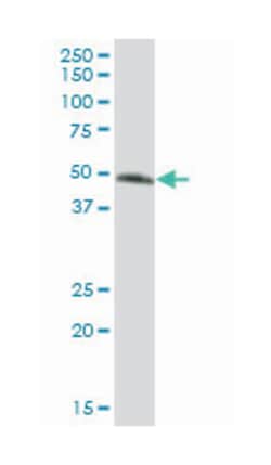 glycoprotein A33 (transmembrane), Mouse, Polyclonal Antibody, Abnova 50&mu;L;