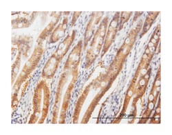 glycoprotein A33 (transmembrane), Mouse, Polyclonal Antibody, Abnova 50&mu;L;