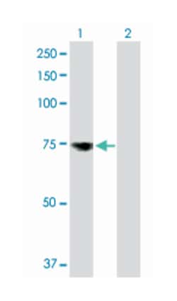 mesothelin, Rabbit, Purified MaxPab Polyclonal Antibody, Abnova 100&mu;g;
