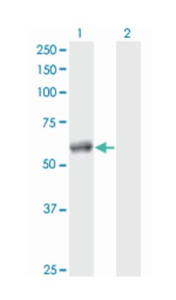 calcium binding and coiled-coil domain 2, Mouse, Clone: 2A11, Abnova 100 &mu;g | Buy Online | Abnova Corporation | Fisher Scientific