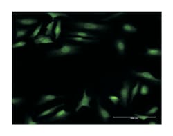 calcium binding and coiled-coil domain 2, Mouse, Clone: 2A11, Abnova 100 &mu;g | Buy Online | Abnova Corporation | Fisher Scientific
