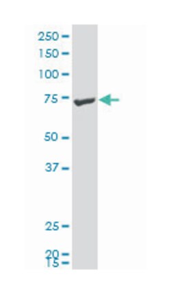 connector enhancer of kinase suppressor of Ras 1 (A01), Mouse anti-Human, Polyclonal Antibody, Abnova 50 &mu;L | Buy Online | Abnova | Fisher Scientific