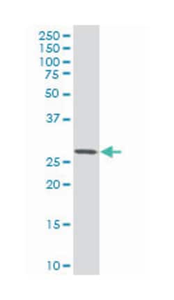 breast carcinoma amplified sequence 2 (A01), Mouse anti-Human, Polyclonal