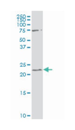 regulator of G-protein signaling 19, Mouse, Polyclonal Antibody, Abnova 50 &mu;L | Buy Online | Abnova Corporation | Fisher Scientific