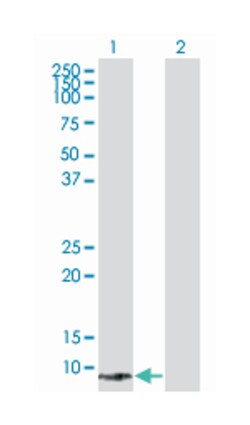SPEG complex locus, Mouse, Polyclonal Antibody, Abnova 50&mu;L; Unlabeled:Antibodies,