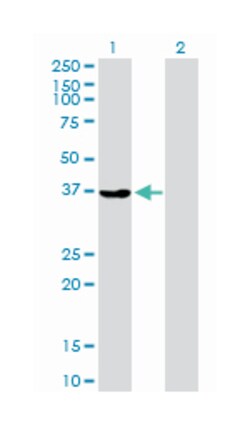 aldo-keto reductase family 1, member A1 (aldehyde reductase), Rabbit, Purified