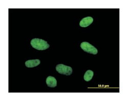 HMG20A, Mouse, Polyclonal Antibody, Abnova 50&mu;g; Unlabeled:Antibodies,