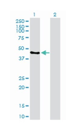 interferon regulatory factor 9, Rabbit, Purified MaxPab Polyclonal Antibody, Abnova 100 &mu;g | Buy Online | Abnova | Fisher Scientific