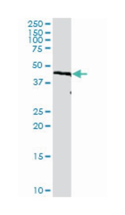 interferon regulatory factor 9, Rabbit, Purified MaxPab Polyclonal Antibody, Abnova 100 &mu;g | Buy Online | Abnova | Fisher Scientific