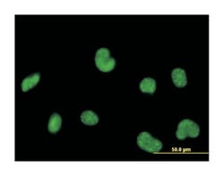 polymerase (RNA) III (DNA directed) polypeptide C (62kDa), Mouse, Polyclonal