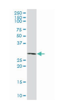 ribonuclease P/MRP 40kDa subunit, Mouse, Polyclonal Antibody, Abnova 50&mu;L;