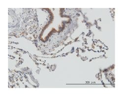 stress-induced-phosphoprotein 1, Mouse, Clone: 1E3, Abnova 100&mu;g; Unlabeled:Antibodies,