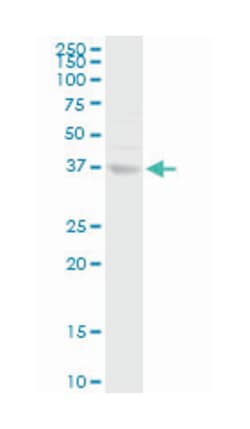 annexin A10, Rabbit, Purified MaxPab Polyclonal Antibody, Abnova 100&mu;g;