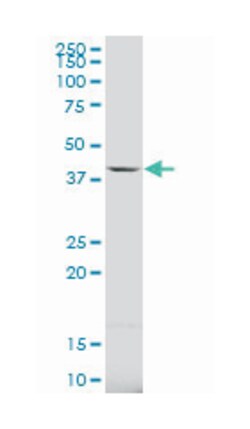 carbonic anhydrase VB, mitochondrial (A01), Mouse anti-Human, Polyclonal