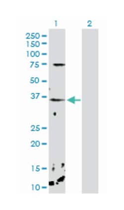 CHP, Rabbit, Purified MaxPab Polyclonal Antibody, Abnova 100&mu;g; Unlabeled:Antibodies,