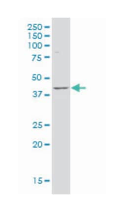 LanC lantibiotic synthetase component C-like 1 (bacterial), Mouse, Polyclonal Antibody, Abnova™