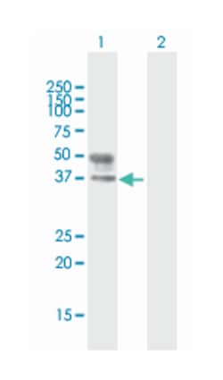 UDP-GlcNAc:betaGal beta-1,3-N-acetylglucosaminyltransferase 3, Mouse, Purified