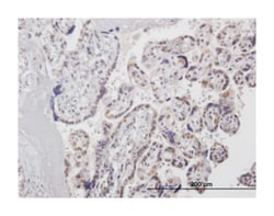 HMG20A, Mouse, Polyclonal Antibody, Abnova 50&mu;g; Unlabeled:Antibodies,