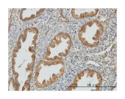 N-myc downstream regulated 1, Mouse, Clone: 2D7, Abnova 100&mu;g; Unlabeled:Antibodies,