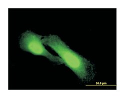N-myc downstream regulated 1, Mouse, Clone: 2D7, Abnova 100&mu;g; Unlabeled:Antibodies,