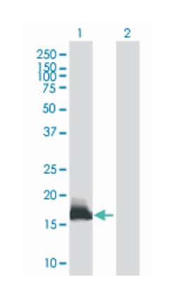 interferon induced transmembrane protein 3 (1-8U), Mouse, Polyclonal Antibody,
