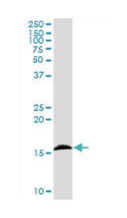 interferon induced transmembrane protein 3 (1-8U) (D03P), Rabbit anti-Human,