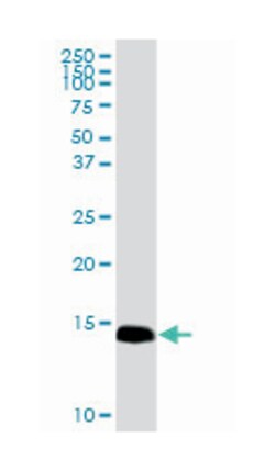 interferon induced transmembrane protein 3 (1-8U) (D03P), Rabbit anti-Human,