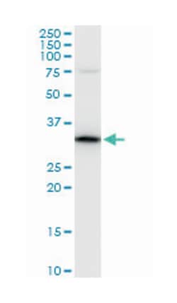 peptidylprolyl isomerase E (cyclophilin E) (A01), Mouse anti-Human, Mouse,
