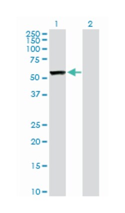CAP, adenylate cyclase-associated protein 1 (yeast), Rabbit, Purified MaxPab