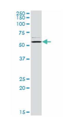 CAP, adenylate cyclase-associated protein 1 (yeast), Rabbit, Purified MaxPab
