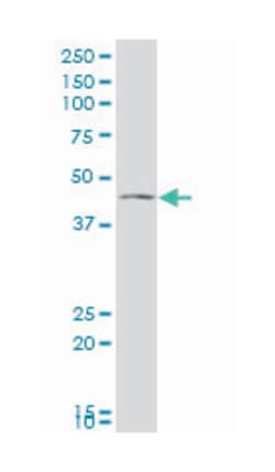 vesicle amine transport protein 1 homolog (T. californica), Mouse, Polyclonal Antibody, Abnova&trade;